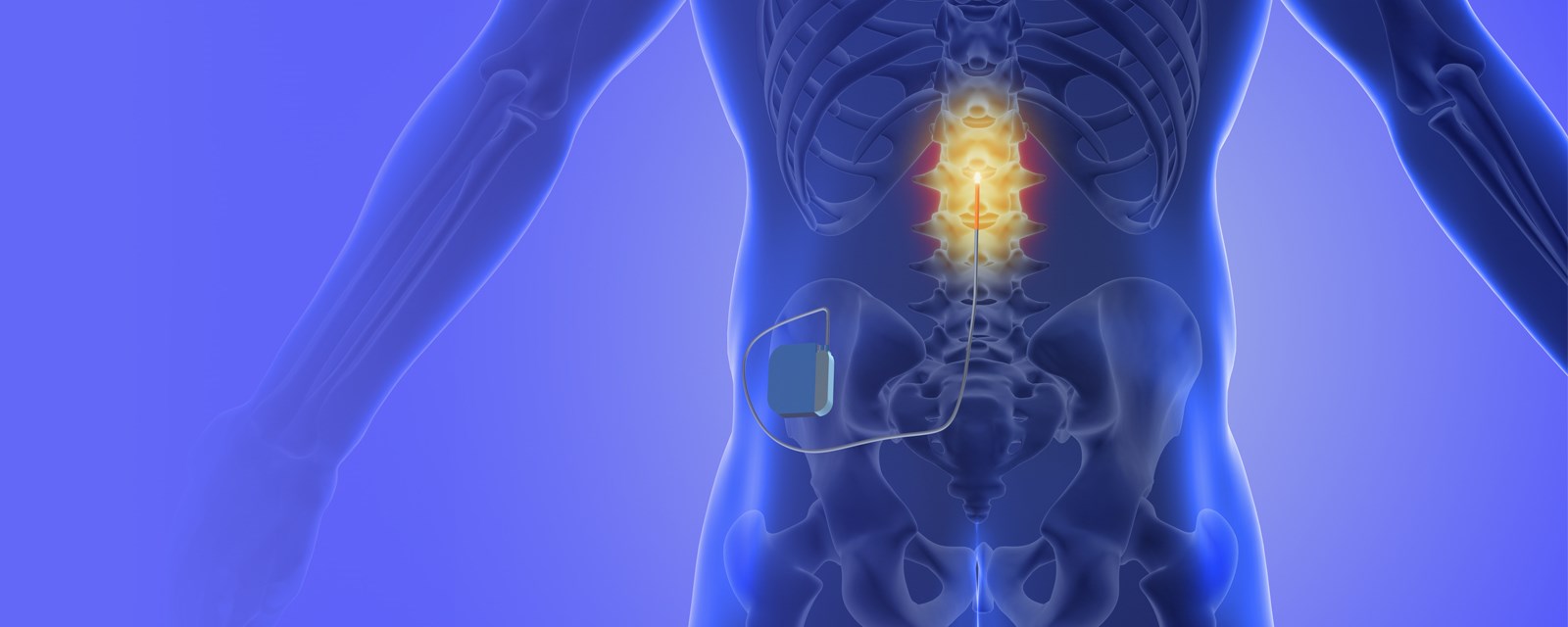 Advanced interventions for pain management